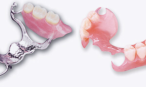 Dentures and Partial Dentures service-11