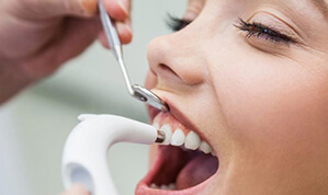 Periodontal Surgery service-6