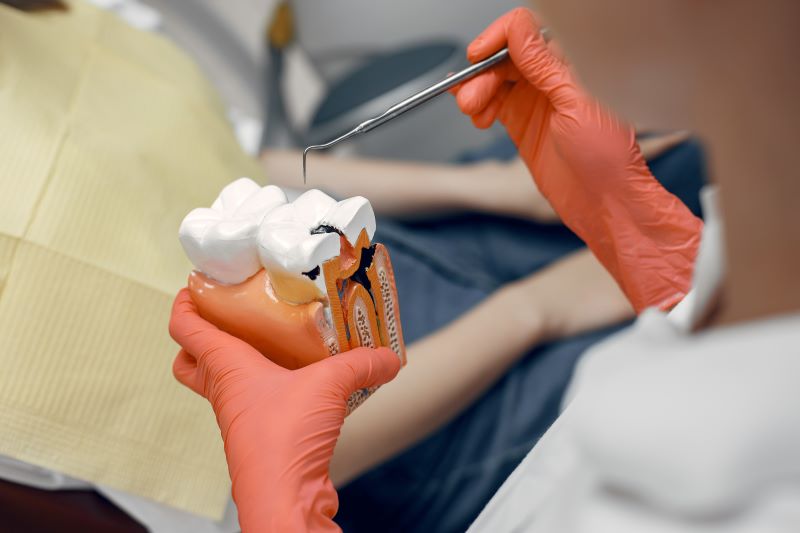 root canal treatment richmond