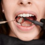 Fix cavities with dental fillings in Richmond. We use tooth-colored materials for strong, natural-looking results. Schedule your visit today!