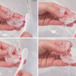 What Is the Best Way to Clean Your Invisalign?