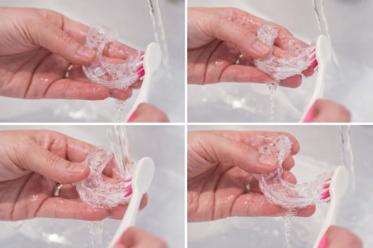 What Is the Best Way to Clean Your Invisalign?