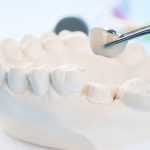 dental examination before crown placement procedure