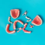 what are the three types of dentures